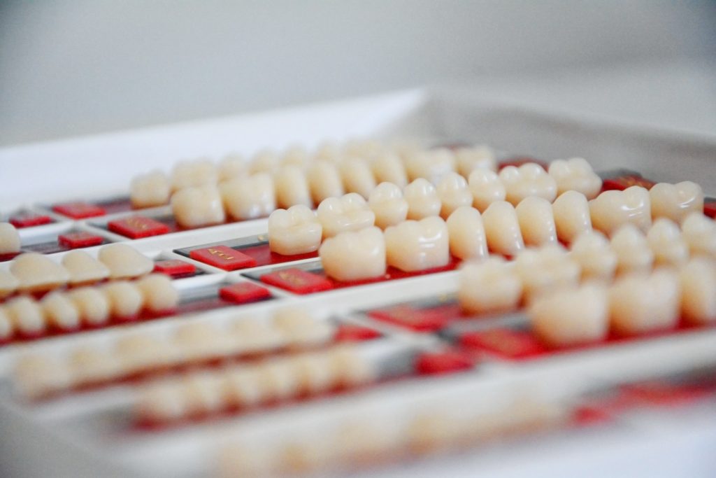 Ce sunt fatetele dentare si pentru ce sunt utilizate?